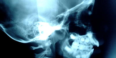 The 3 Most Dangerous Injuries A Batter Can Face